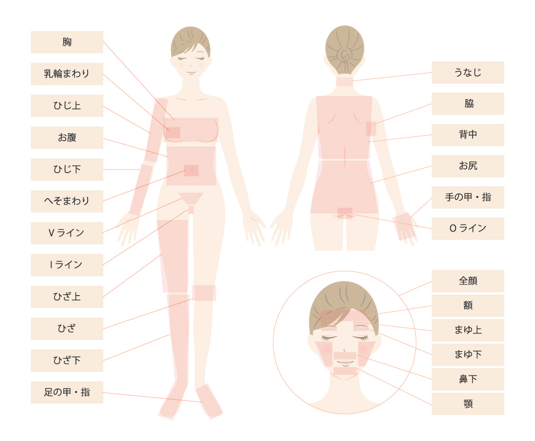 腕、顔、VIO、全身脱毛が可能